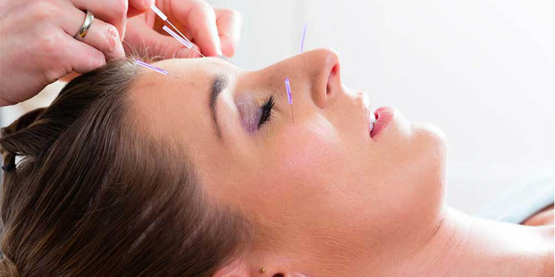 acupuncture therapy - chineseherbalremedies.website