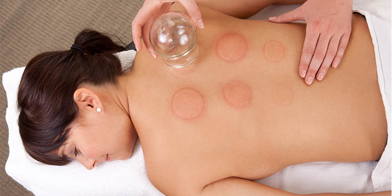 cupping therapy - chineseherbalremedies.website